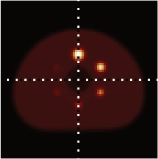 False-colour PET image of a NEMA-type reference phantom, showing spheres against a background